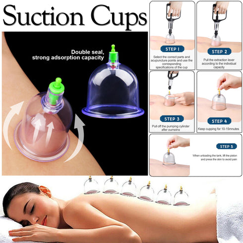 12 Pieces Cupping Therapy Set - Vaccuum Massage Cups