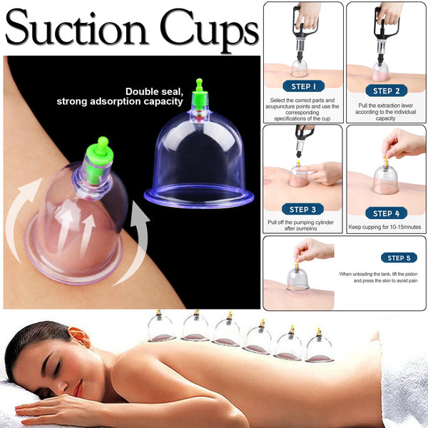 12 Pieces Cupping Therapy Set - Vaccuum Massage Cups