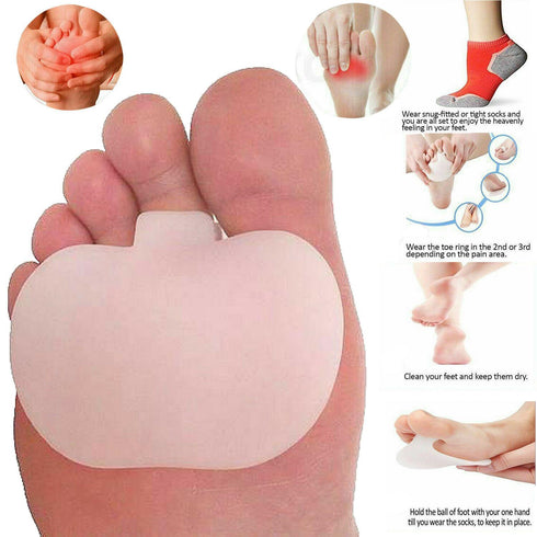 10-Pack Metatarsal Gel Pads – Ball of Foot Cushions - 40p Per Unit