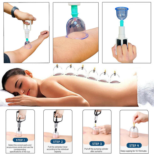 12 Pieces Cupping Therapy Set - Vaccuum Massage Cups